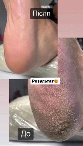 Молекулярное масло Nail Doza для педикюра спрей 50 мл Молекулярна олія NailDoza Molecular Oil для педикюру (спрей) ) 50 мл. фото